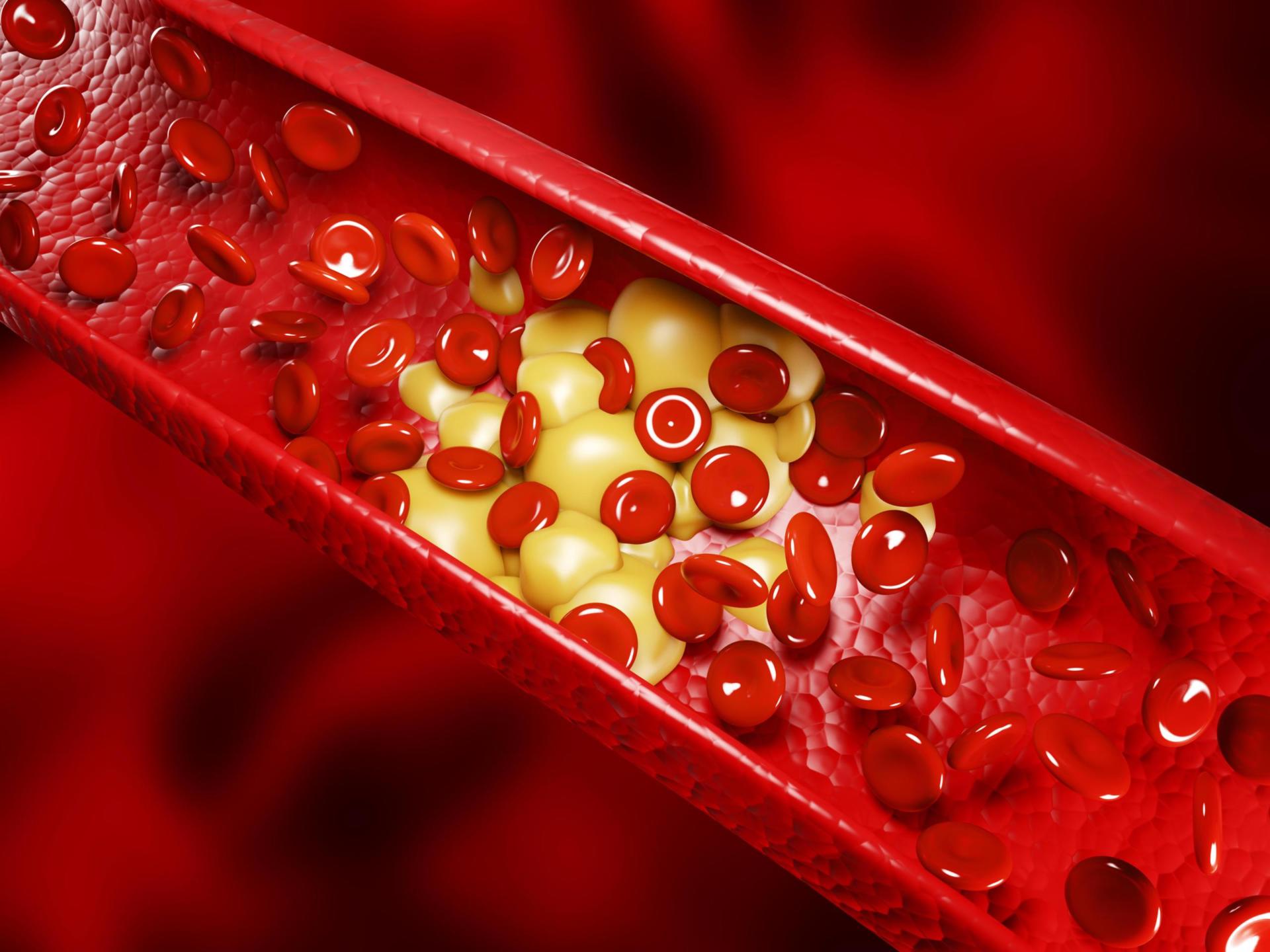 Entenda os Riscos do Colesterol Alto e Como Controlá-lo - Diagnosticor